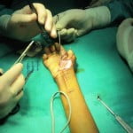 hand surgery taking place