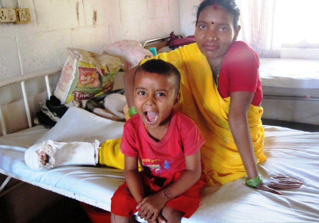 01.-Ajay-4yrs-Mum-who-had-reconstructive-surg 01.-Ajay-4yrs-Mum-who-had-reconstructive-surg