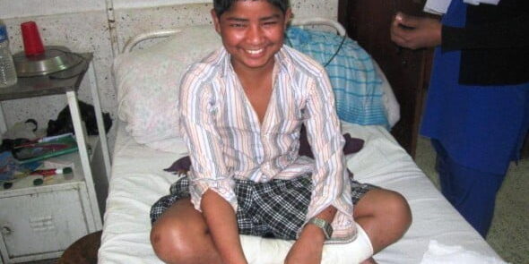3.-Soudaga-SAPHI-age-14-cheerful-despite-a-nasty-Leprosy-Type2-reaction-590x442 3.-Soudaga-SAPHI-age-14-cheerful-despite-a-nasty-Leprosy-Type2-reaction-590x442